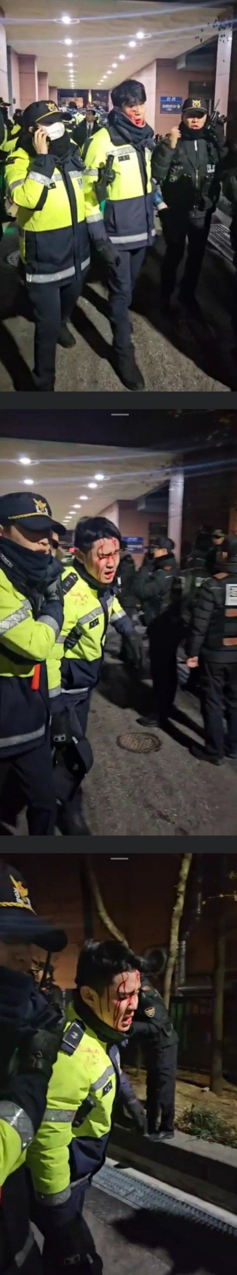 찾아봤는데 저러다가 진짜 사람 하나 죽이겠다 살인미수죄로 엄벌 처했으면