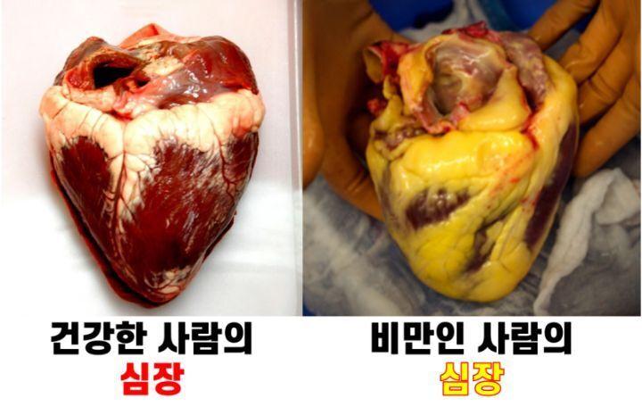이런거