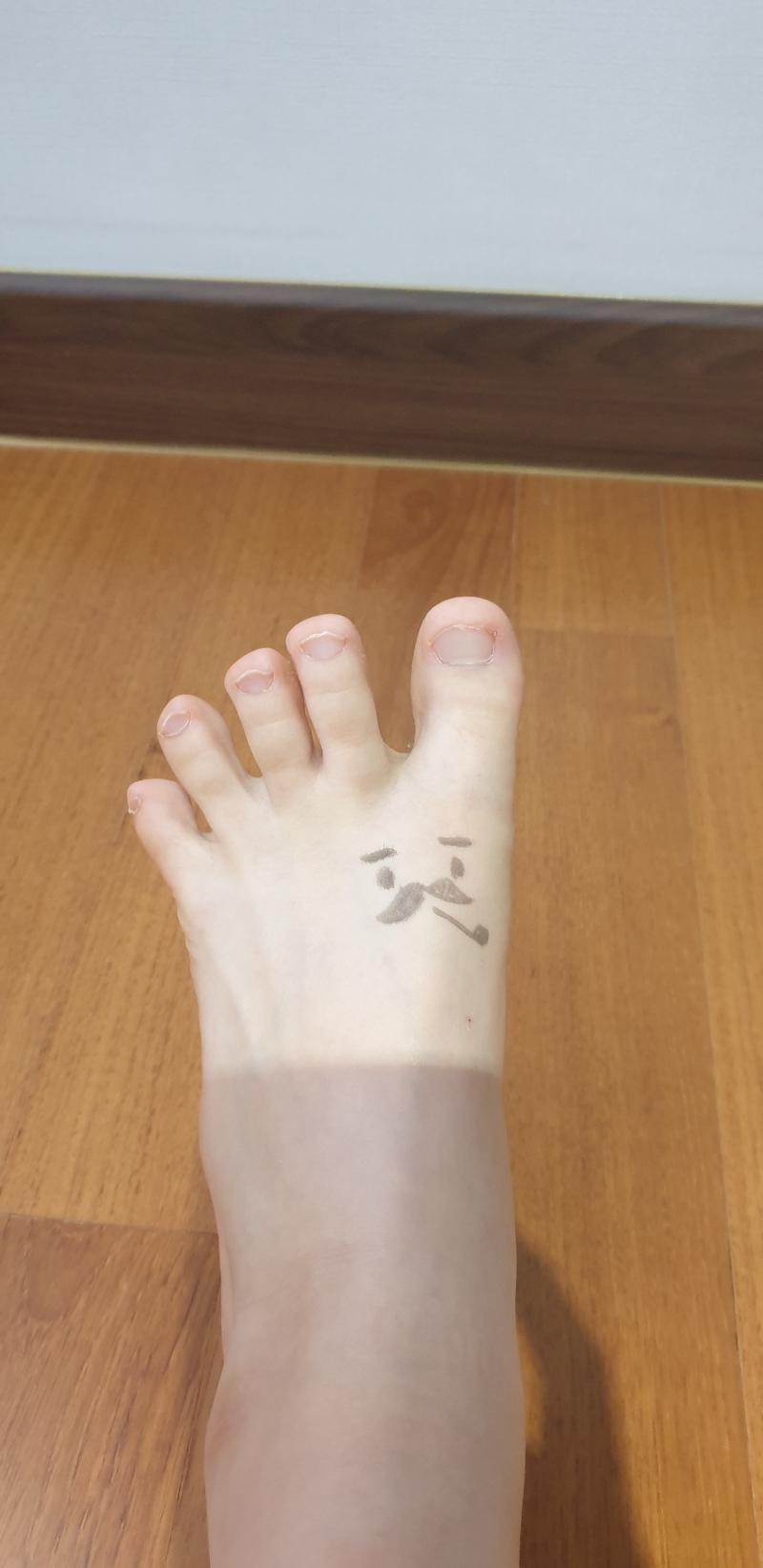 기영이 머리
