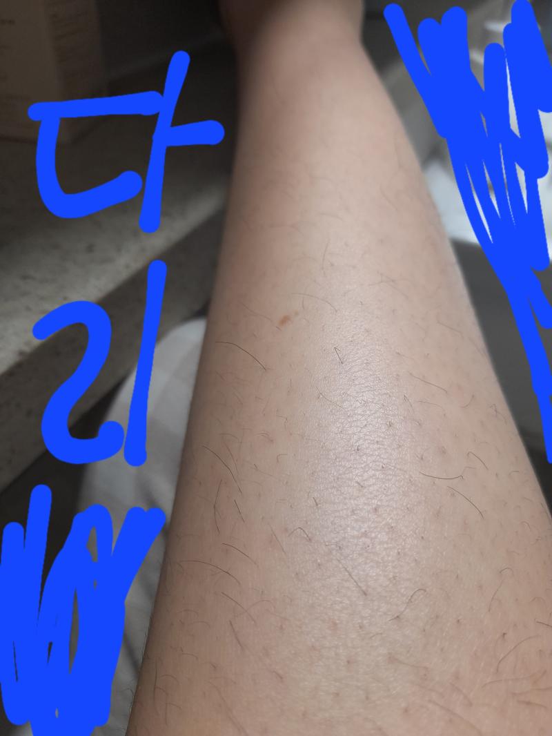 사진으론 보이는데 밝은 데서 실물로 보면 진짜 역겨워 미치겠어 그리고 제모크림이랑 왁스테이프 써봤는데 크림은 다음 테이프는 뒤에 바로 털이 사진만 보고 너보단 내가 많다 이런