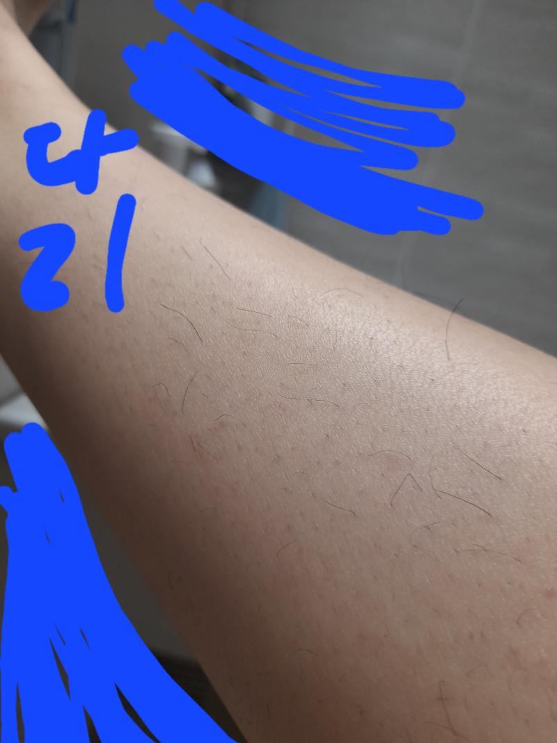 사진으론 보이는데 밝은 데서 실물로 보면 진짜 역겨워 미치겠어 그리고 제모크림이랑 왁스테이프 써봤는데 크림은 다음 테이프는 뒤에 바로 털이 사진만 보고 너보단 내가 많다 이런