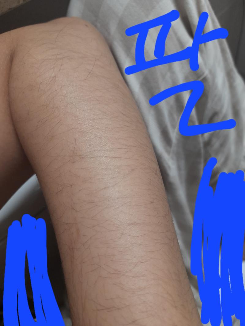 사진으론 보이는데 밝은 데서 실물로 보면 진짜 역겨워 미치겠어 그리고 제모크림이랑 왁스테이프 써봤는데 크림은 다음 테이프는 뒤에 바로 털이 사진만 보고 너보단 내가 많다 이런