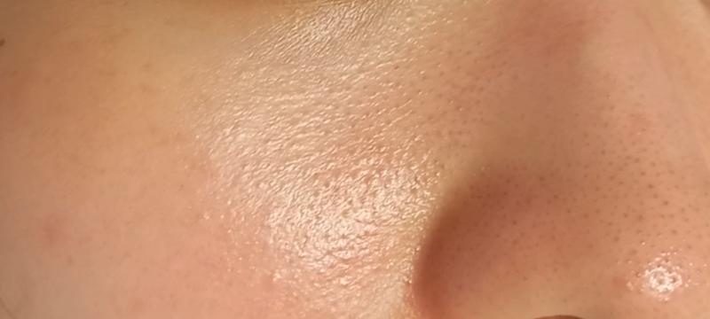 일차 토너 파티온 노스카나인 트러블 클리어 토너 세럼 vt 시카 레티놀 크림 파티온 노스카나인 흔적 리페어 크림 레티놀이 색소침착이랑 요철에 좋다해서 써봄 쓴지 일차 인데 부작용
