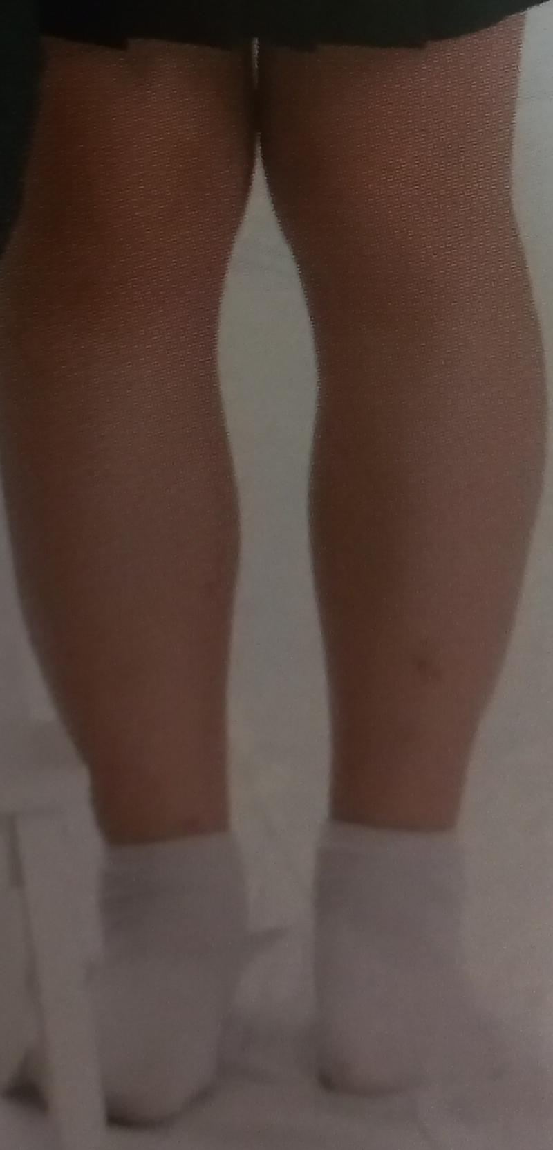 X자 아니고 살짝 벌려서 찍은거야