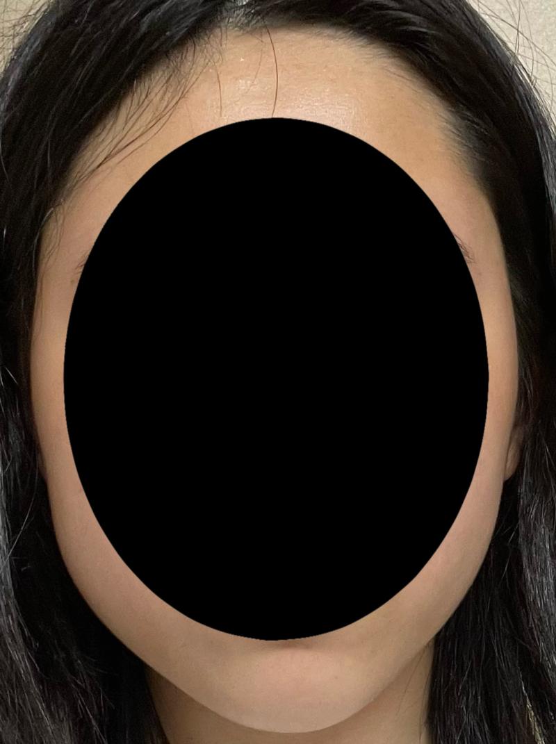 이목구비는 가렸어
