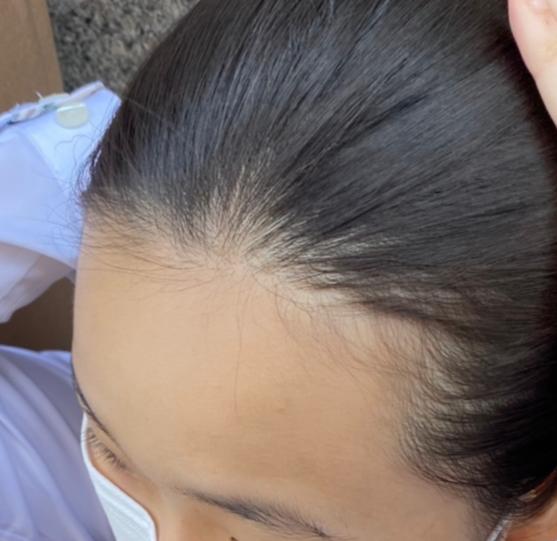 이래생김 이마가 매우 넓고 빤딱거리는 특징있음