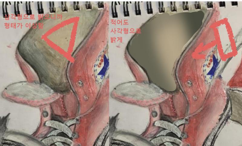 여기 고칠 있음