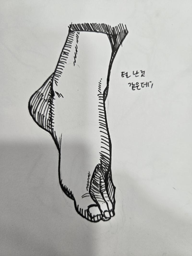 쌤들이 피부에 해칭 넣지 말라는데엔 이유가 있다