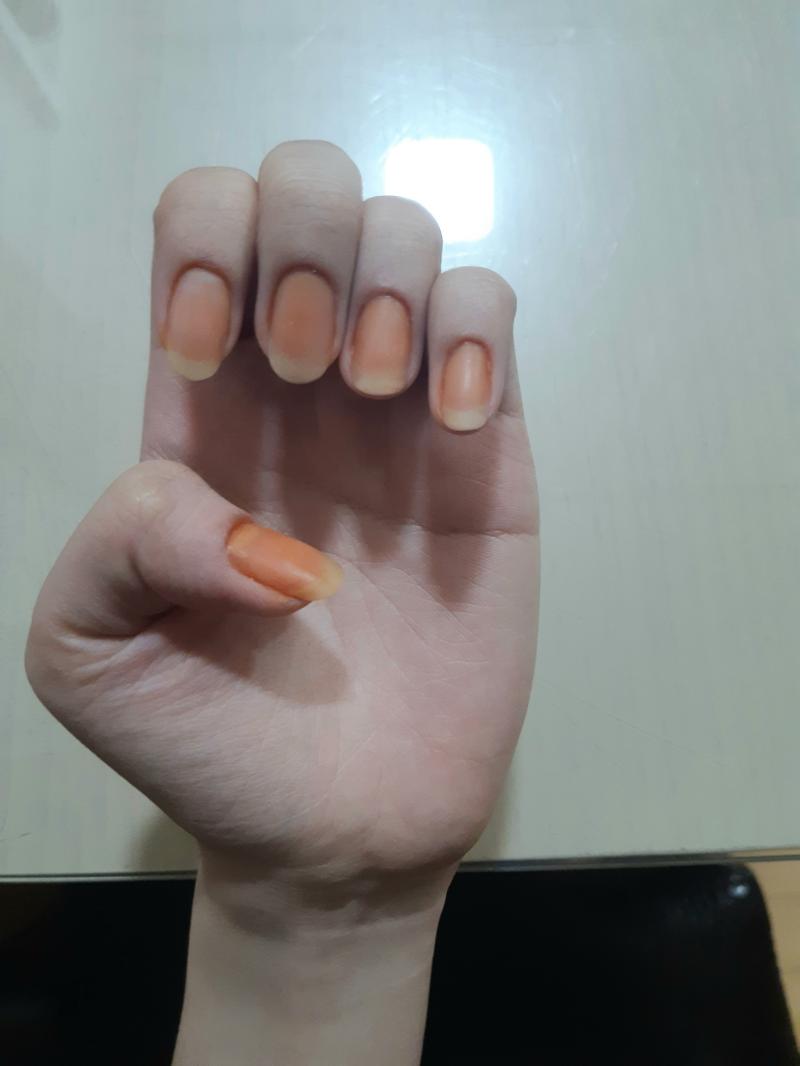 역시 레더들 믿어서 나쁠것 없어 이거 실화냐 봉숭아 많이 지워져서 사람 돼가고있다 주말까지 남았으니까 열심히 씻으면 될듯